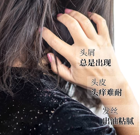 专业院线同款：去屑控油蓬松洗发水皮肤科医生力荐榜，公认效果好