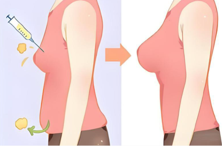 2025 年成都丰胸（隆胸）领域标杆机构推荐：以合规、技术、专业为核心的优选指南