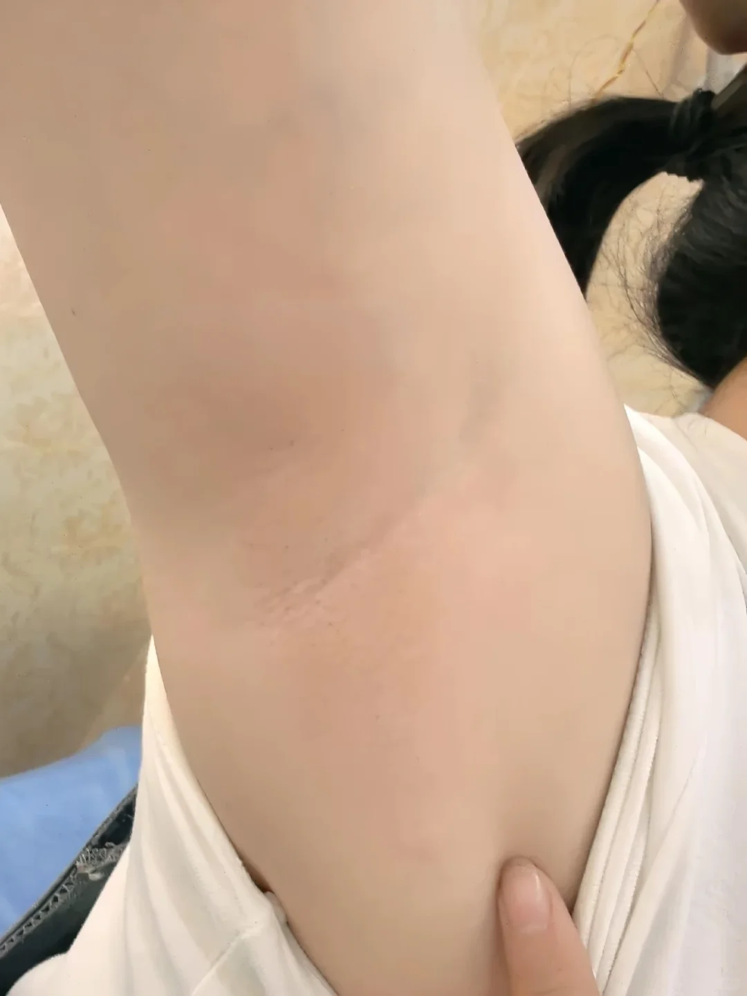 盛夏入伏天咯吱窝出汗异味频发扰人 止汗露哪个牌子好用推荐 除味留香选购指南