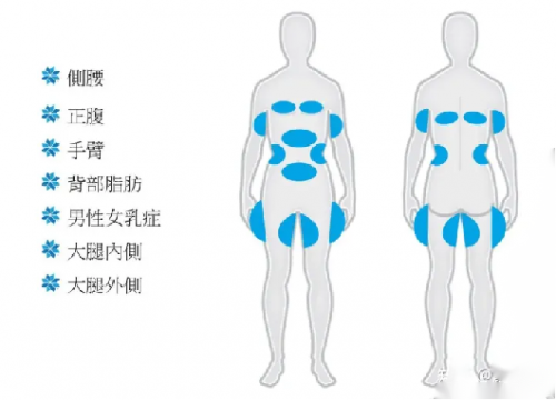 酷塑冷冻溶脂的副作用