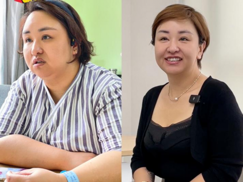206斤儿科医生在长春嘉和外科医院接受减重手术 两年后怎么样了