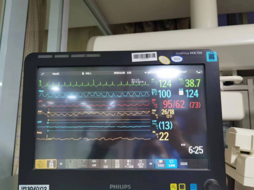 吉大一院心脏外科成功植入吉林省首颗左心室辅助装置人工心脏