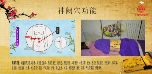 紫德堂瘦身保健膏，中医贴敷疗法治疗肥胖