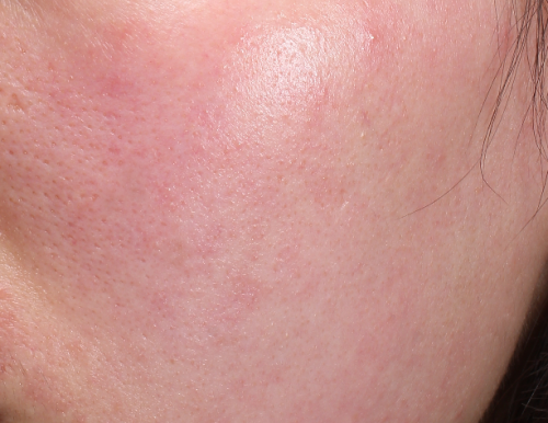 弥玥泉喷雾的宝藏用法大揭秘！秋冬这么用脸越来越水灵！