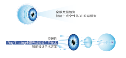 【新技术发布】爱尔眼科青海“一城两院”即将推出“全光塑”个性化近视手术技术