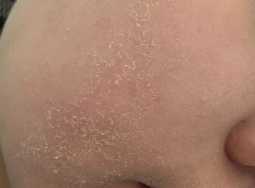 打破冬季脸干 “魔咒”,弥玥泉喷雾实力润养,重拾水润肌