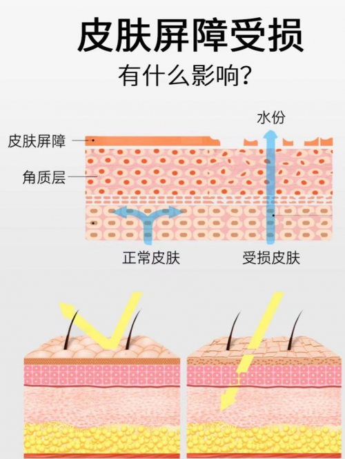 打破冬季脸干 “魔咒”,弥玥泉喷雾实力润养,重拾水润肌