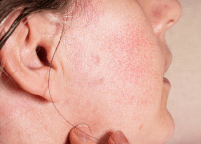 春节肌肤急救神器弥玥泉，一瓶多用，让你美美哒迎新年