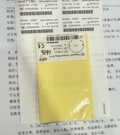 高度近视合并白内障患者重获清晰视界 术后感慨：早该做了
