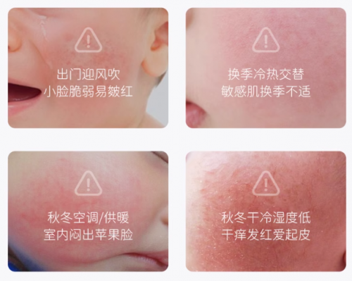 新生兒能用保濕霜嗎？夏天需要用嗎？