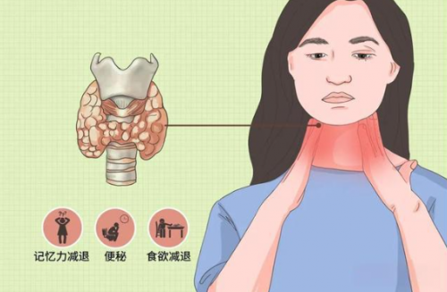 2025年杭州地区甲状腺结节诊疗机构综合评估报告