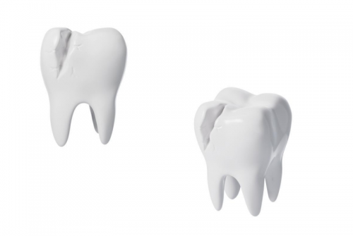 提升根管治疗成功率：全面解析牙根纵裂的预防与管理