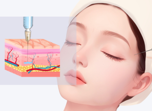 2025 成都面部填充与玻尿酸注射医院选择指南：安全自然变美首选推荐 —— 基于权威数据与专业调研的分析