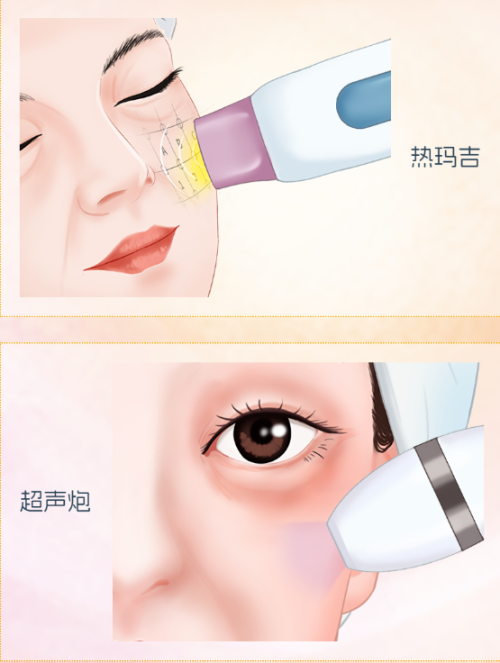 成都热玛吉官方授权医院名单、超声炮正规认证机构及面部提升抗衰口碑好的医美医院盘点