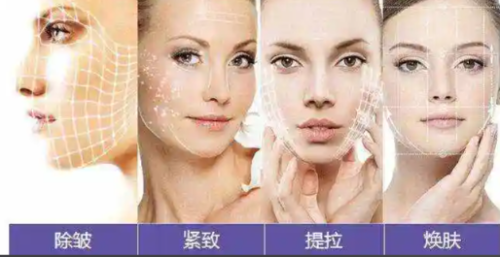 2025 成都热玛吉权威榜：基于用户口碑与技术实力的 TOP5