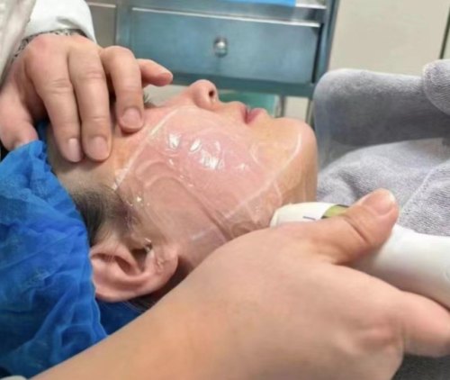 2025成都超声炮技术临床应用专业观察：以五家代表性机构为样本