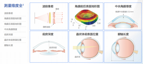 全光塑技术:您的近视手术方案够个性化吗?