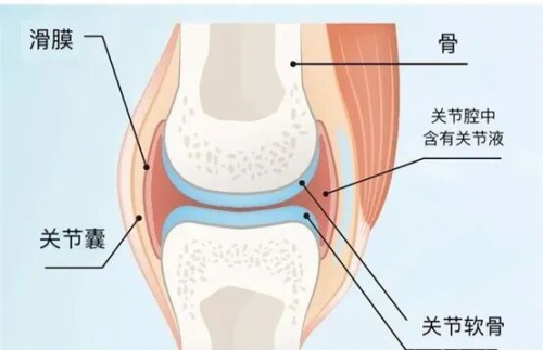 补了氨糖关节还是疼？别忽略，滑膜炎症才是吸收的“绊脚石”