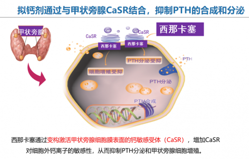 静福欣盐酸西那卡塞：为慢性肾脏病患者点亮希望之光