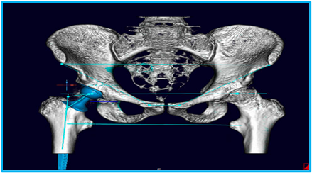 智能穿刺教具走进医学课堂 助力基层医疗人才培…
