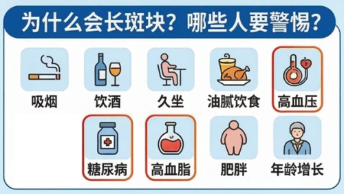 颈动脉狭窄治疗