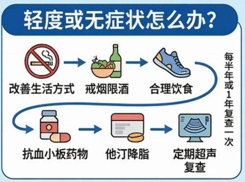 颈动脉狭窄治疗