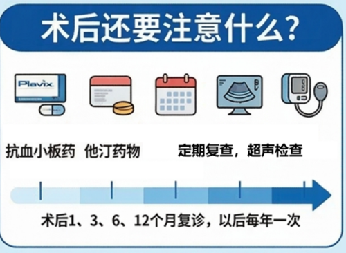 颈动脉狭窄治疗