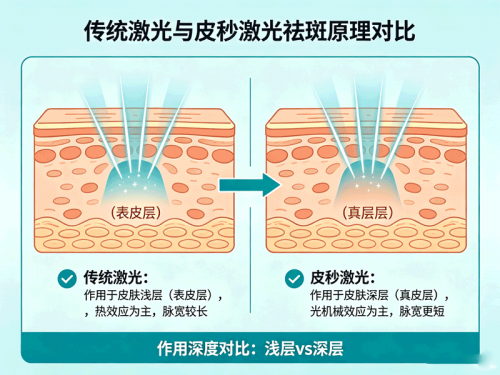 广州激光祛斑 vs 皮秒祛斑：美恩专家教你如何选择.doc