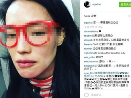 告别“玻璃肌”!皮肤科专家许剑伦主任亲授敏感肌修复秘诀 告别“玻璃肌”!皮肤科专家许剑伦主任亲授敏感肌修复秘诀