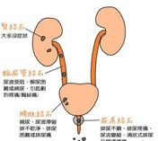 尿路结石的主要症状是什么？血尿、排尿异常需谨慎，应及早就医