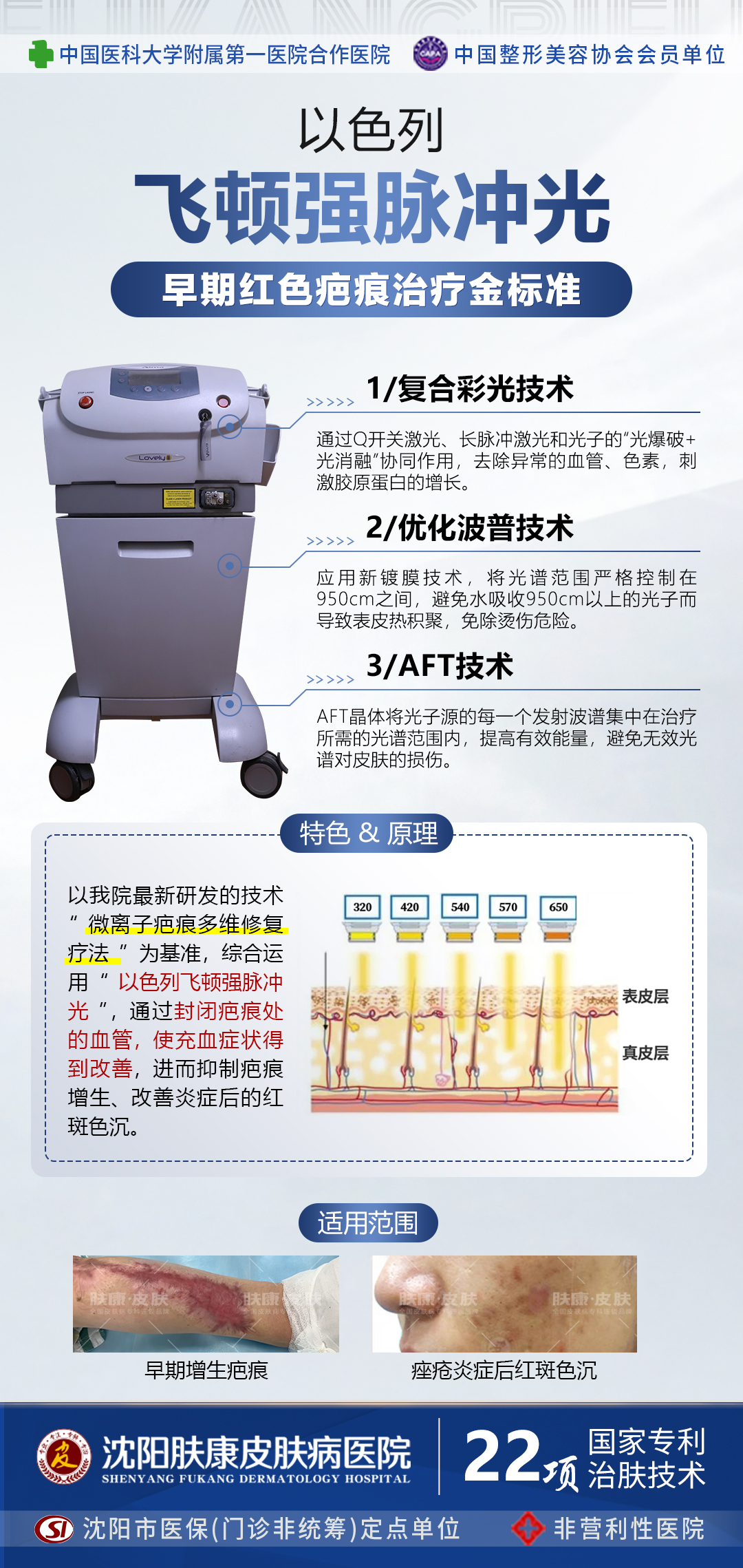 疤痕 机械图