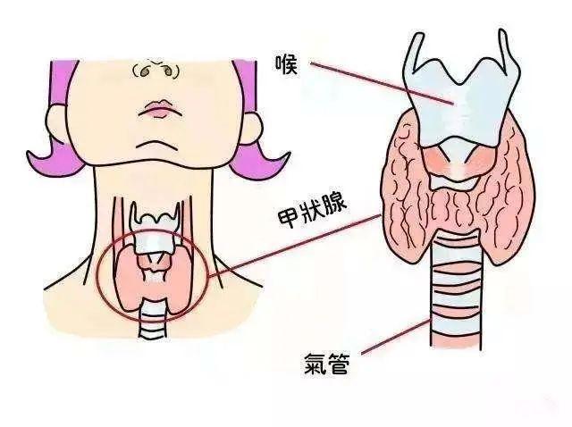 南宁中南甲状腺医院：体检查出甲状腺结节怎么办？答案在这里！