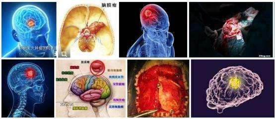 http://www.zxal.cn/uploads/word/20220930/d55690948ea25f6adb9aaa3eb7fcaafa_html_862312a2cfae07dd.jpg