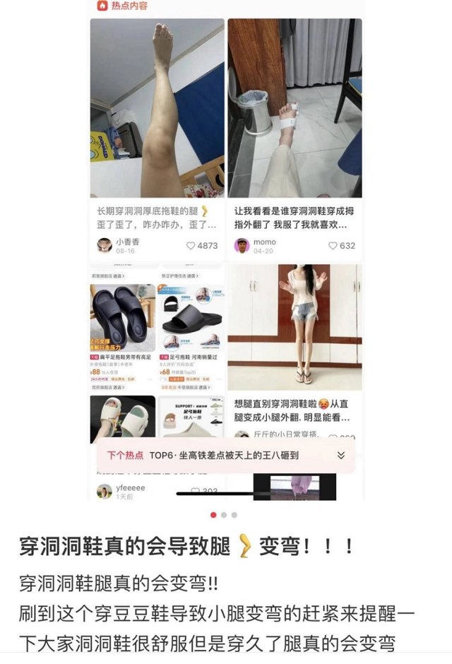 洞洞鞋：职场足部健康的时尚悖论