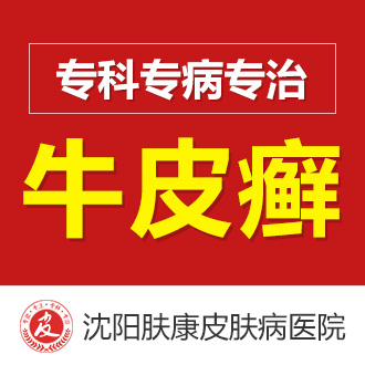 多年牛皮癣如何治疗好？寻根问药，综合调理是关键！