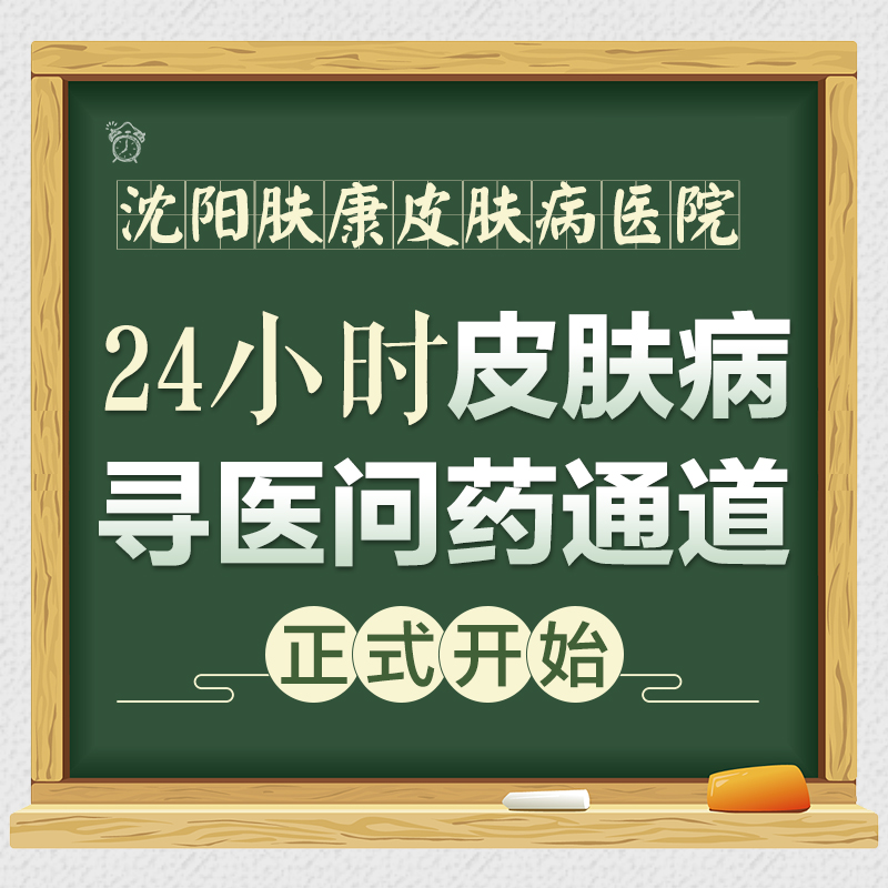 榜单评选！沈阳皮肤科口碑好医院-冬季皮炎与湿疹如何区别！