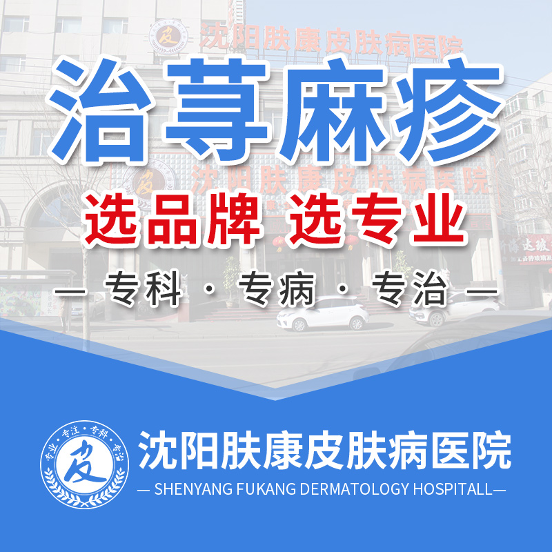 沈阳荨麻疹医院排名哪家好：慢性荨麻疹不治疗会有什么后果？