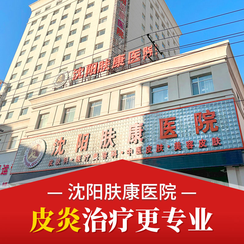“热搜推荐”沈阳看过敏性皮炎那个医院好！