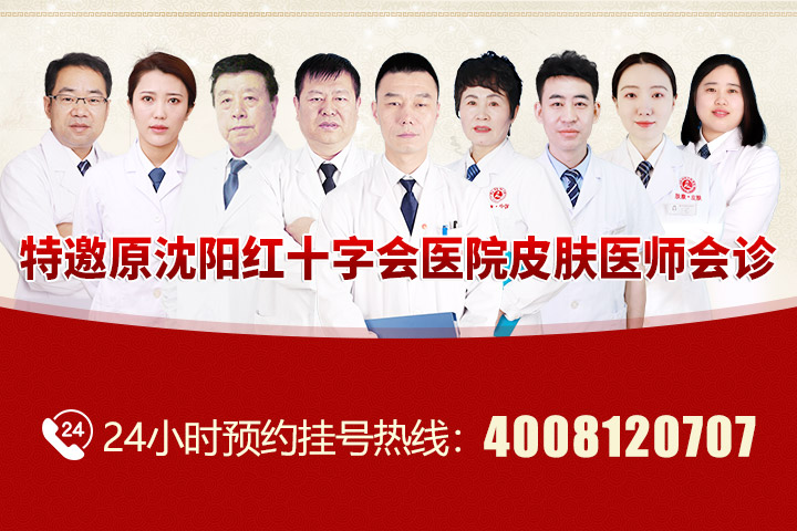 沈阳肤康医院看过敏性皮炎的效果评价