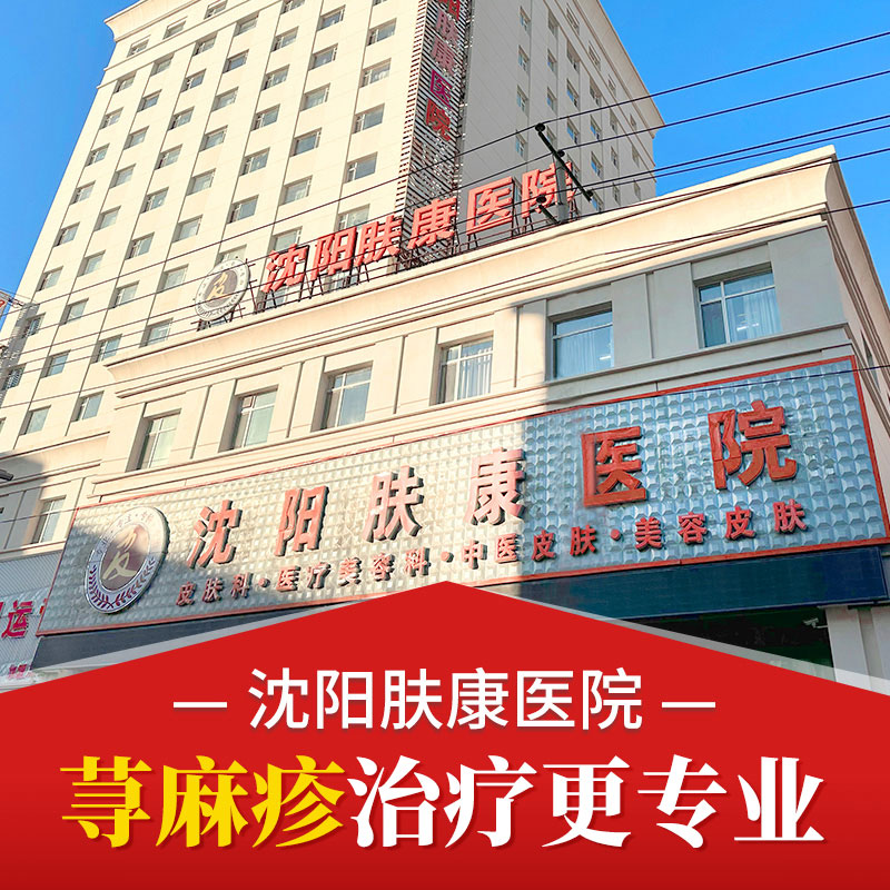 沈阳皮肤病专科医院：沈阳肤康医院荨麻疹治疗需要多少钱！！