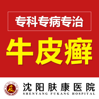 沈阳市皮肤病名声好的医院“热搜”怎么有效预防牛皮癣复发！