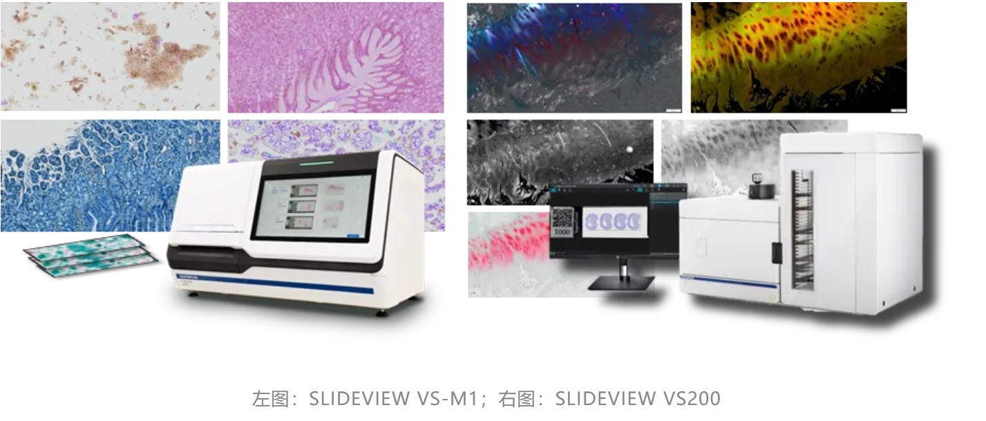 EVIDENT SLIDEVIEW系列化身破局利剑，助力数智病理转型