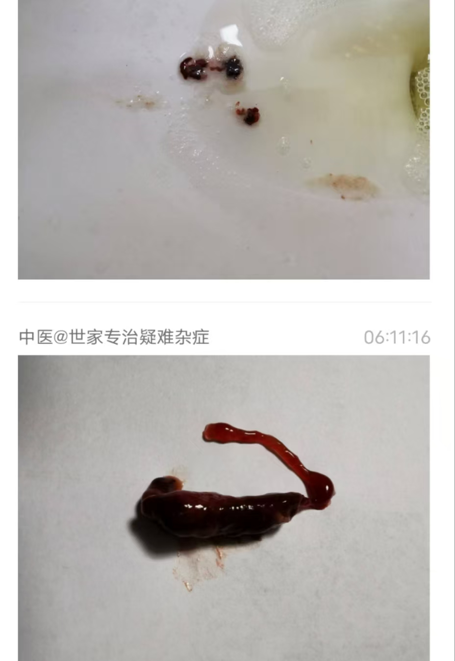 eefb0c4064eca4d23359bc75bc68f95