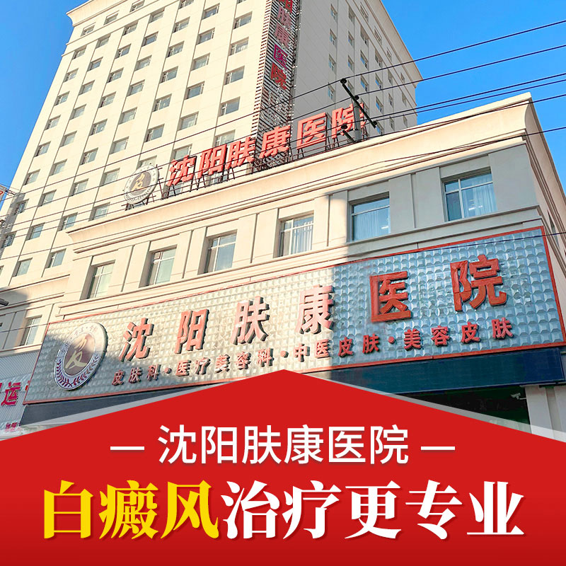 沈阳肤康医院「专科专治」白癜风要怎么预防扩散