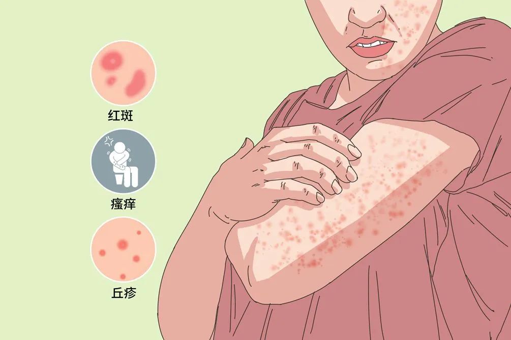 世界过敏性疾病日-重视过敏反应，别让“小毛病”拖成大问题