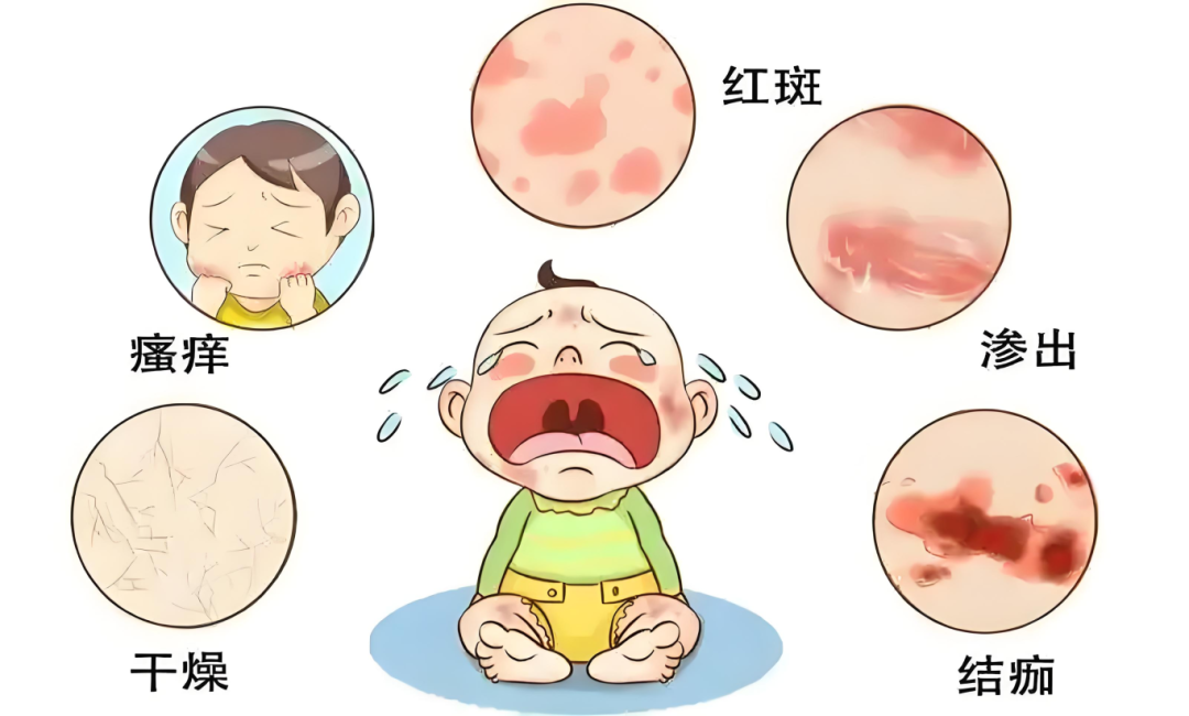 世界过敏性疾病日-重视过敏反应，别让“小毛病”拖成大问题