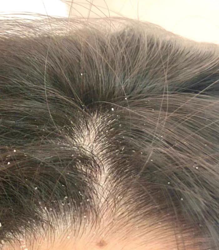 去屑控油洗发水怎么选?这几款亲测有效,能解燃眉之急! 去屑控油洗发水怎么选?这几款亲测有效,能解燃眉之急!