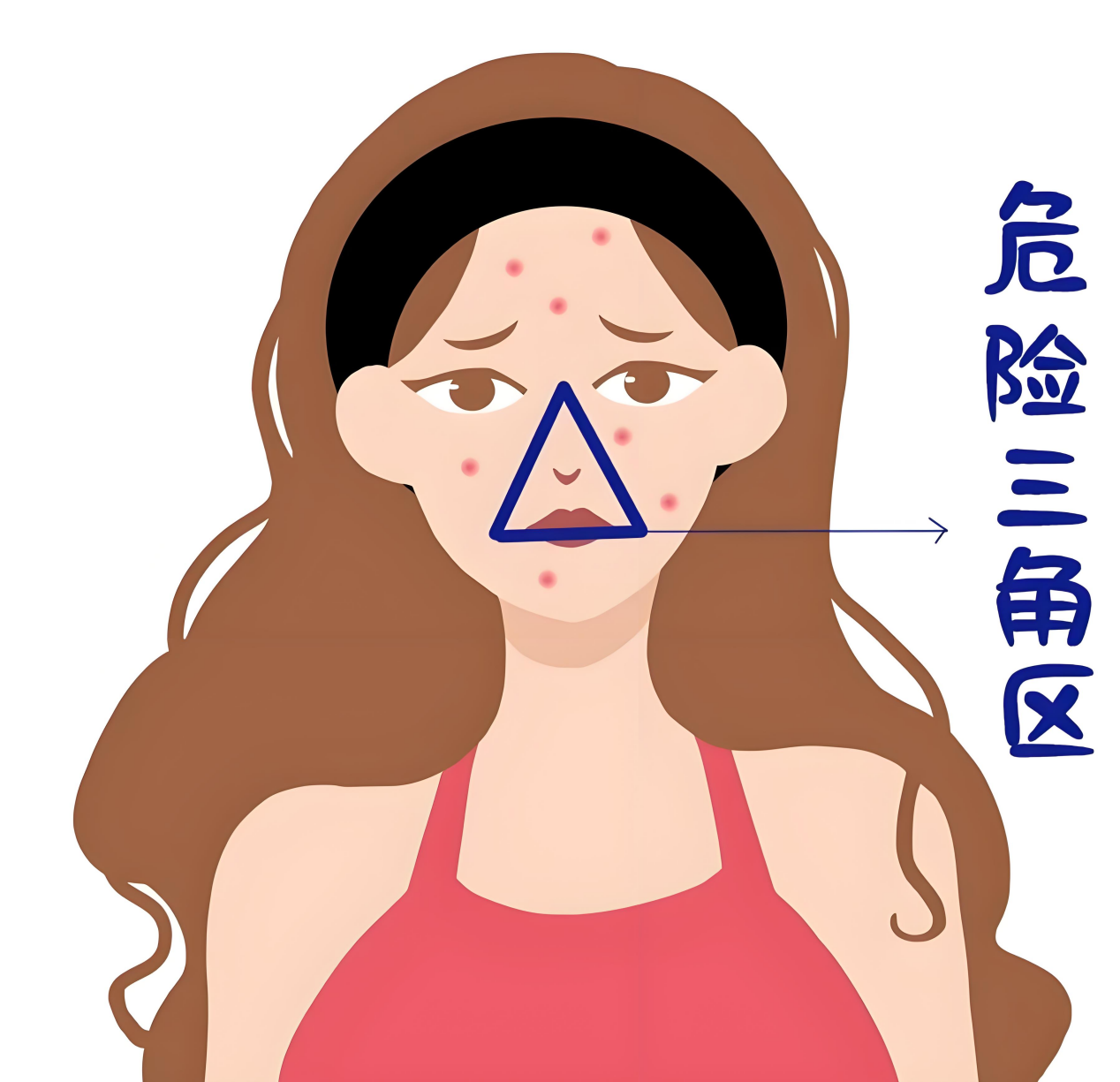 一颗痘痘引发的“血案”：危险三角区挤痘有多可怕？