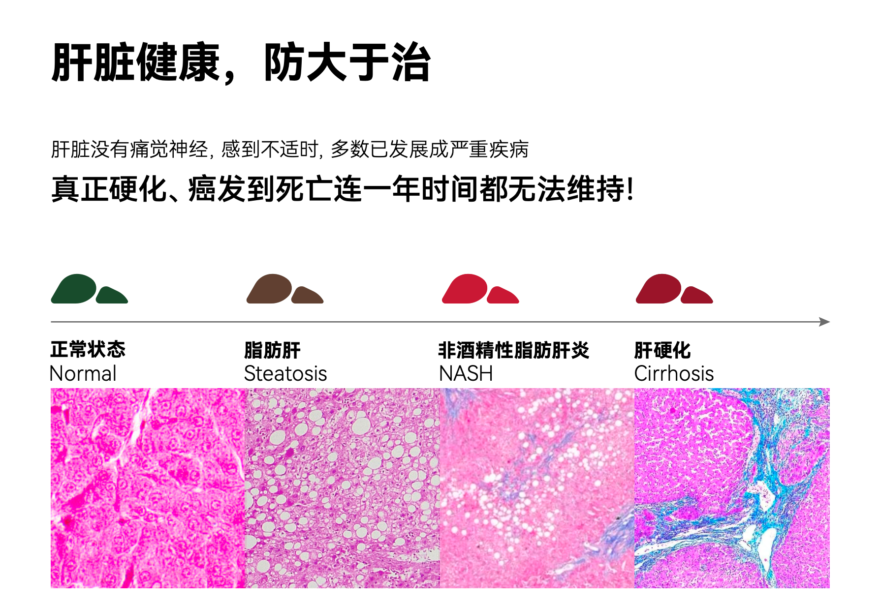 护肝即护健康,LAIFE「乐轻肝」以AI赋能打造科学配方 护肝即护健康,LAIFE「乐轻肝」以AI赋能打造科学配方