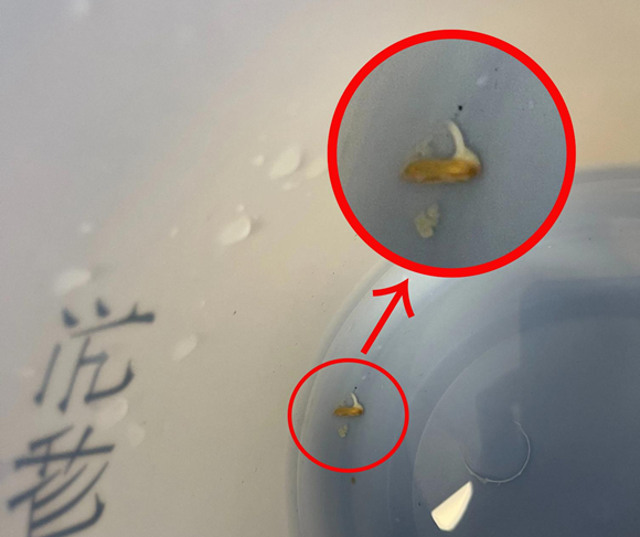 谷物入眼竟发芽！永春爱尔眼科医院紧急提醒